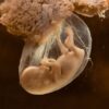 Modelo embrionário humano não nascido.