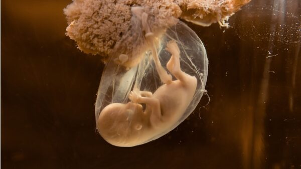 Modelo embrionário humano não nascido.